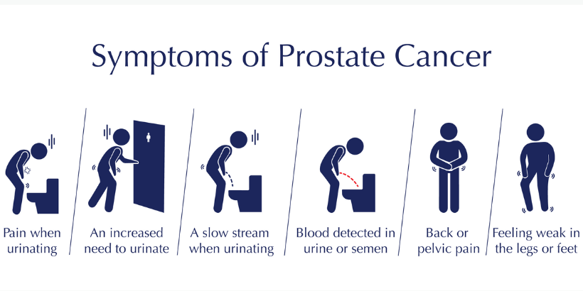 Prostate Cancer