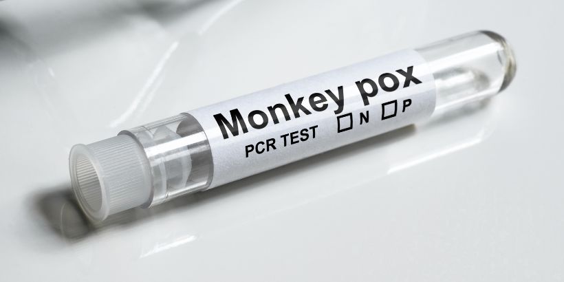 Monkeypox treatment