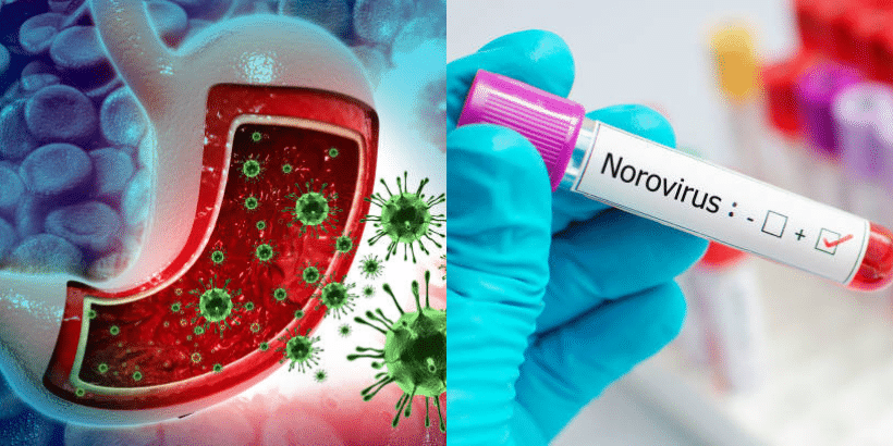 Norovirus