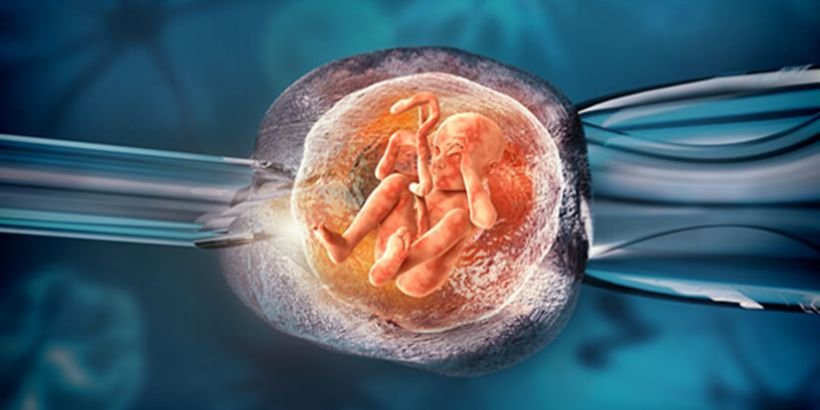 IVF myths
